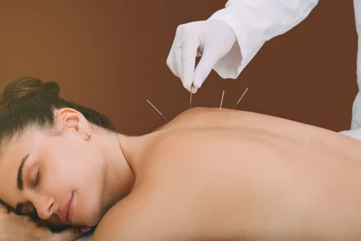Top 10 Benefits Of Acupuncture