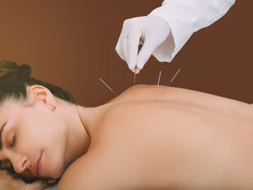 Top 10 Benefits Of Acupuncture